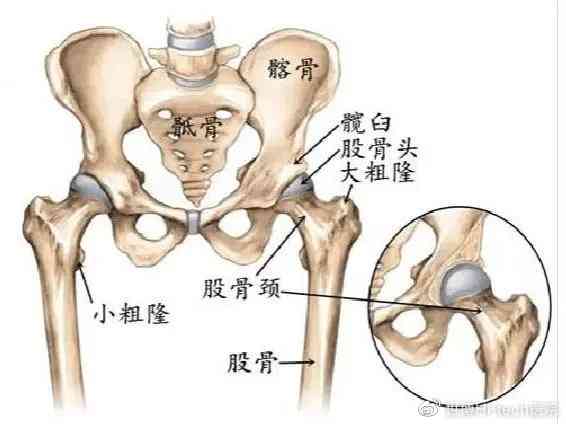 骨头末端骨折：治疗方式、严重程度、恢复周期及治愈可能性解析