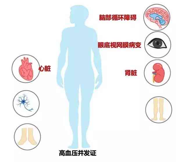 术后并发症：如何界定医疗事故与正常医疗风险？