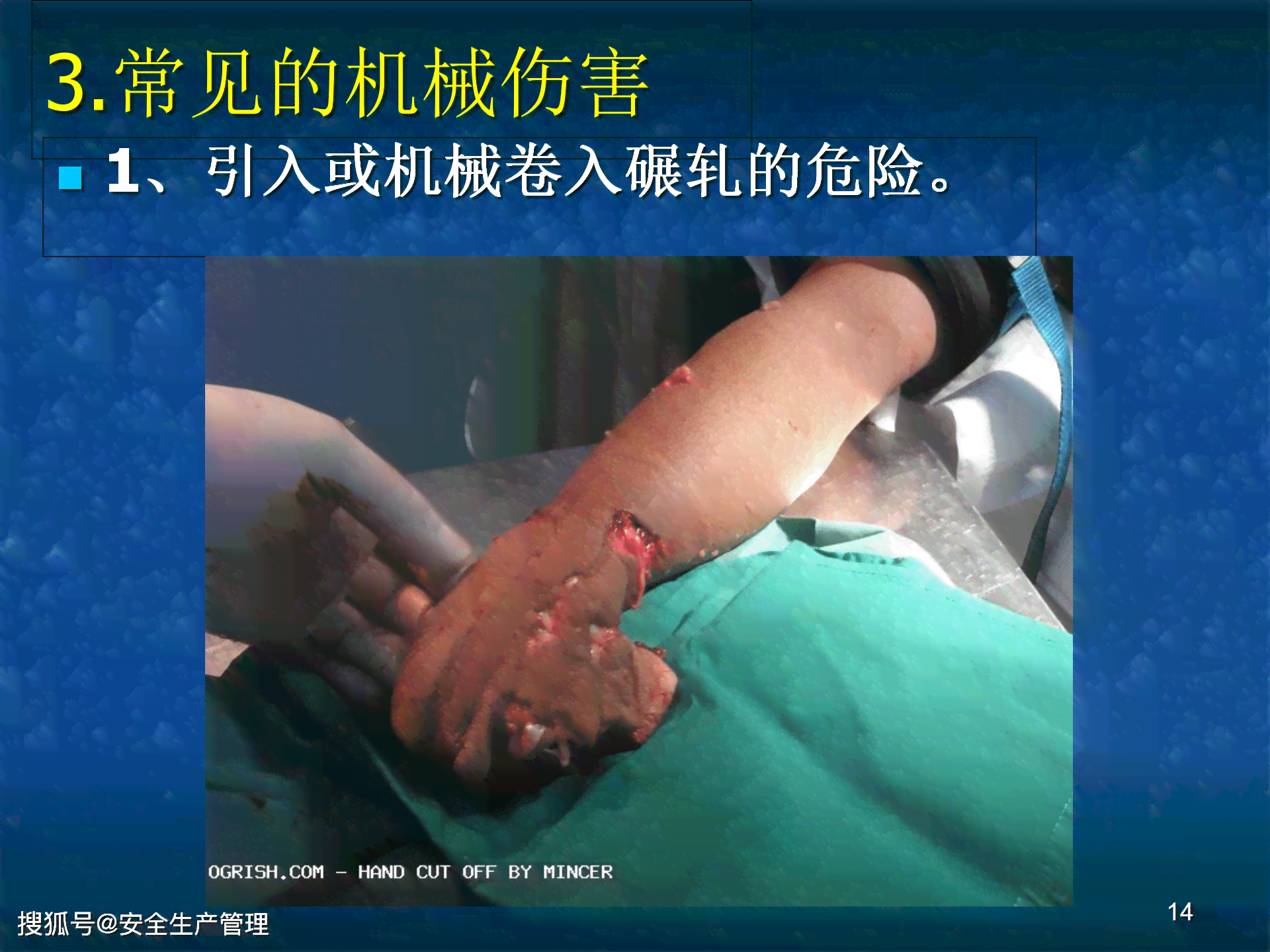 机器绞伤所致怎么回事——事故原因与预防措解析