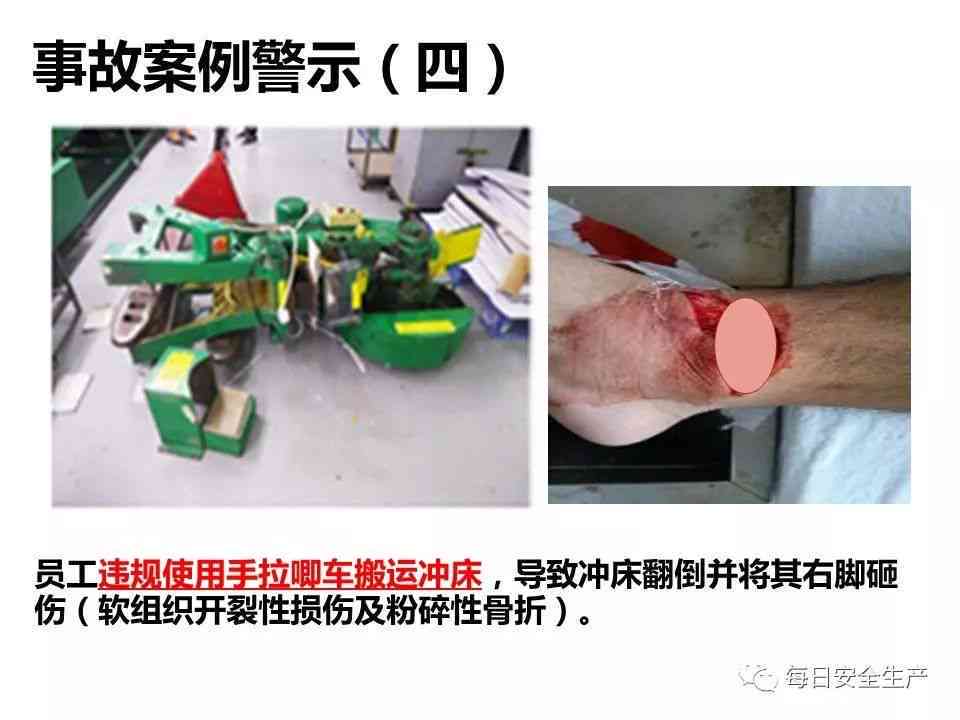 机器绞伤所致怎么回事——事故原因与预防措解析