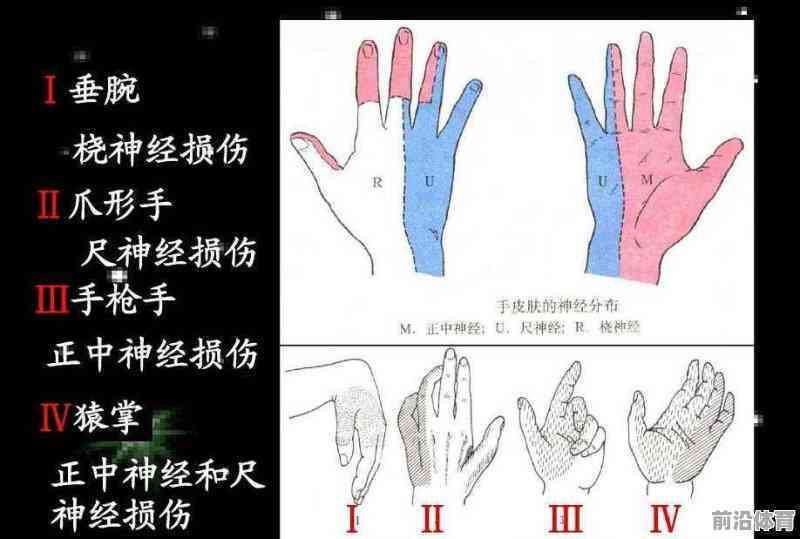 桡神经损伤患者如何评定残疾等级及评残标准解析