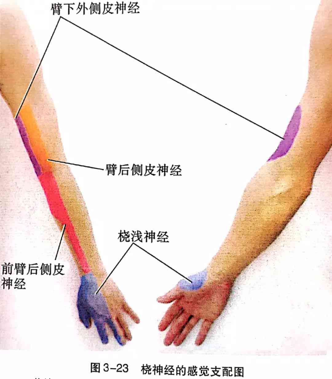 桡神经损伤患者如何评定残疾等级及评残标准解析