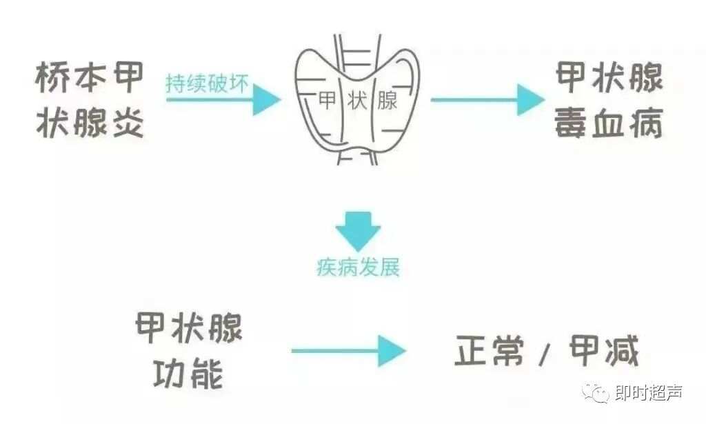桥本氏甲状腺炎工伤认定新标准：纳入工伤补偿范畴