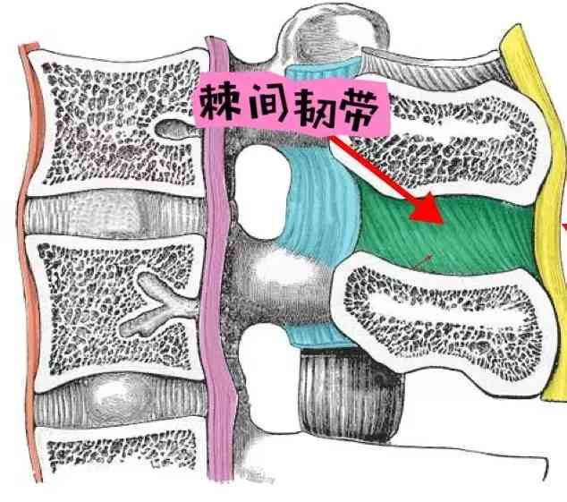 棘间韧带炎能认定工伤吗