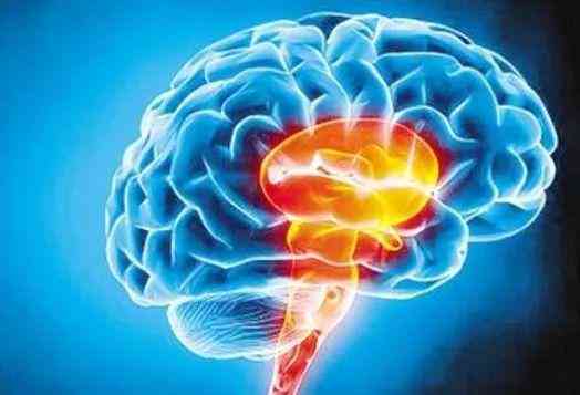 植物人再次脑出血：症状、治疗、存活时间及救治可能性探讨