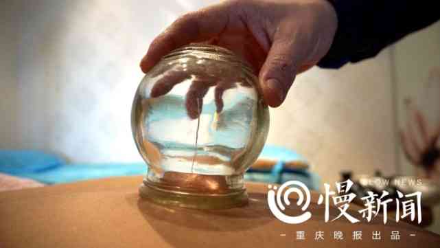 腰椎椎崩裂治疗与复：探讨手术与非手术疗法及其效果对比