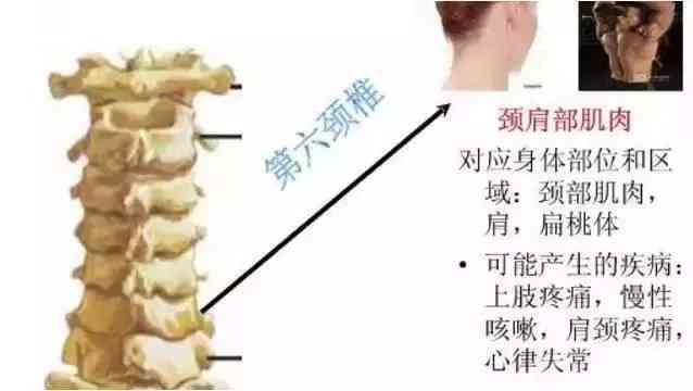 椎板炎怎么认定工伤