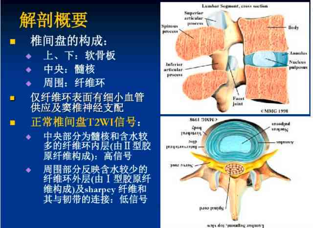 腰椎间盘突出症工伤等级认定的具体流程与标准