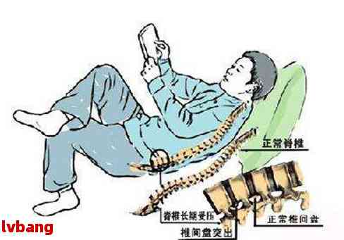 椎间盘膨出能认定工伤吗多少钱，工伤赔偿标准详解