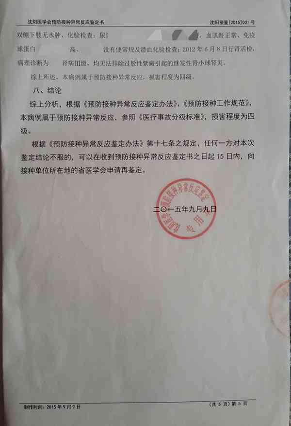 腰椎盘膨出是否属于工伤认定范畴及鉴定标准解析