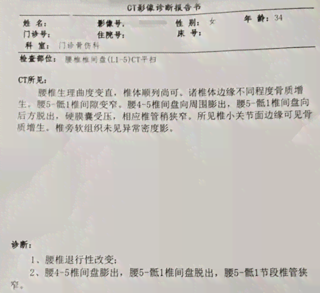 椎间盘膨出能认定工伤嘛赔偿多少及腰椎间盘膨出工伤认定与每日赔偿标准