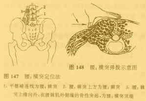 横突综合征能认定工伤吗
