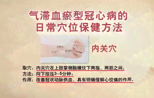 气滞血瘀影响寿命：中医如何看待其与健 longevity 的关联
