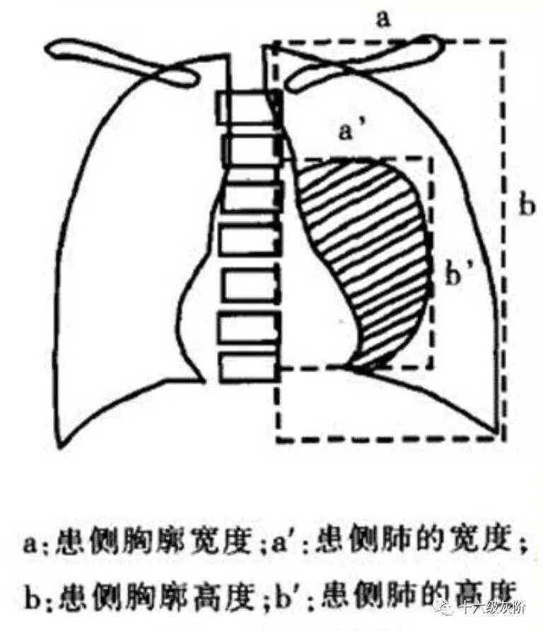 探讨气胸是否被认定为伤残等级的标准与条件