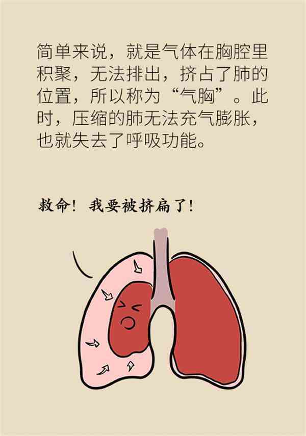 气胸对身体健的影响及其伤残评定标准解读