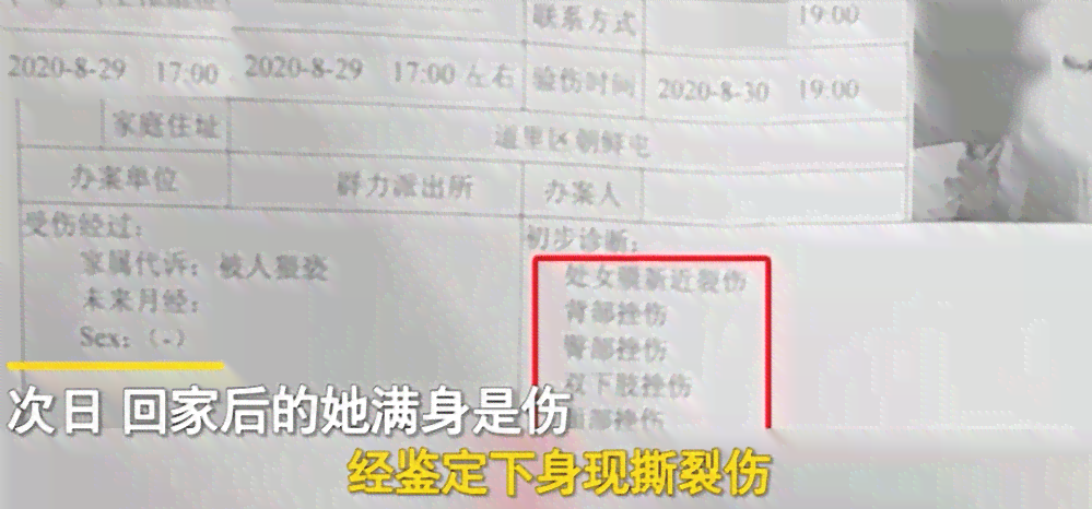 氯中能不能认定工伤等级及伤残评定