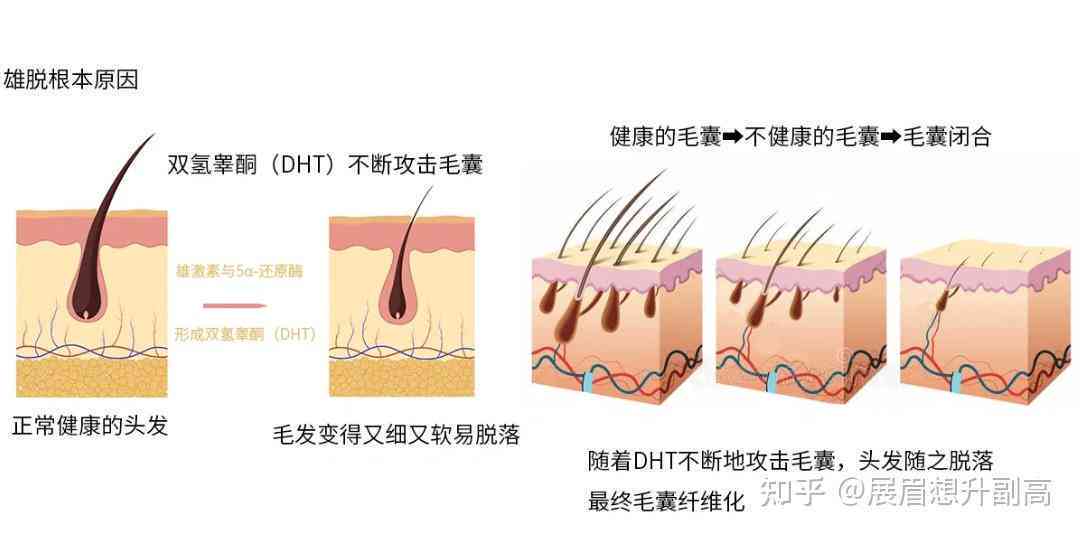 汽油烧伤后皮肤愈合过程与复管理
