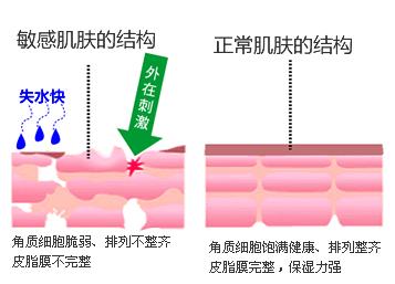 汽油烧伤后皮肤愈合过程与复策略探讨