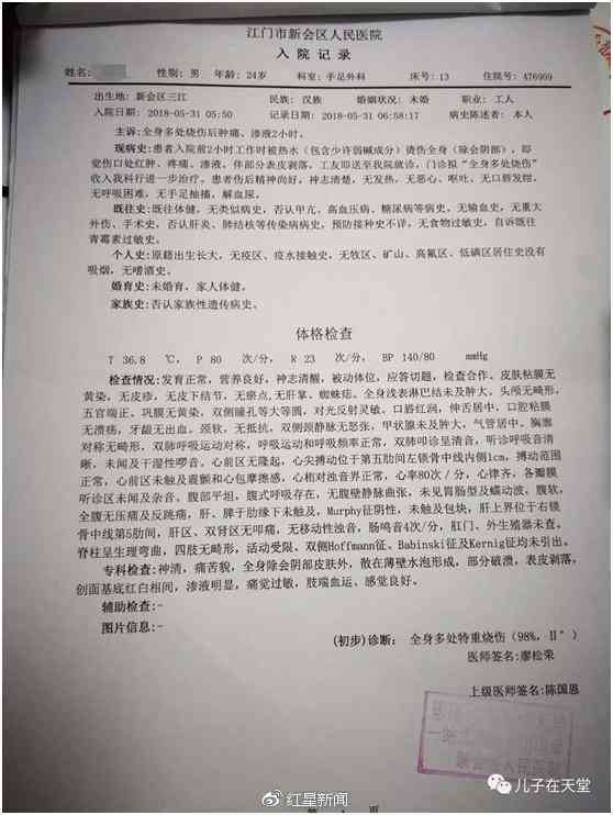 烫伤怎么认定工伤