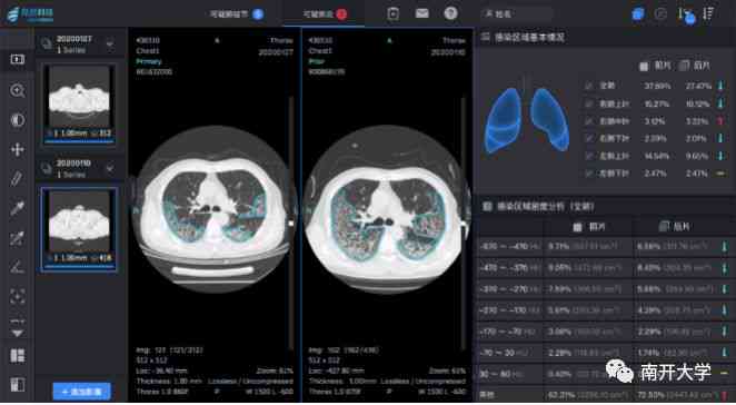 ai看磁共振报告的软件