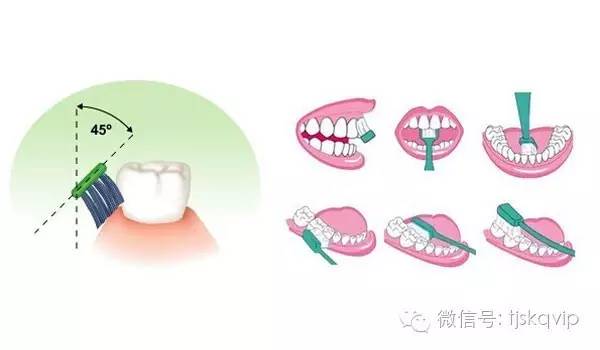 '牙齿被打致脱落：如何判定其损伤等级与法律后果'
