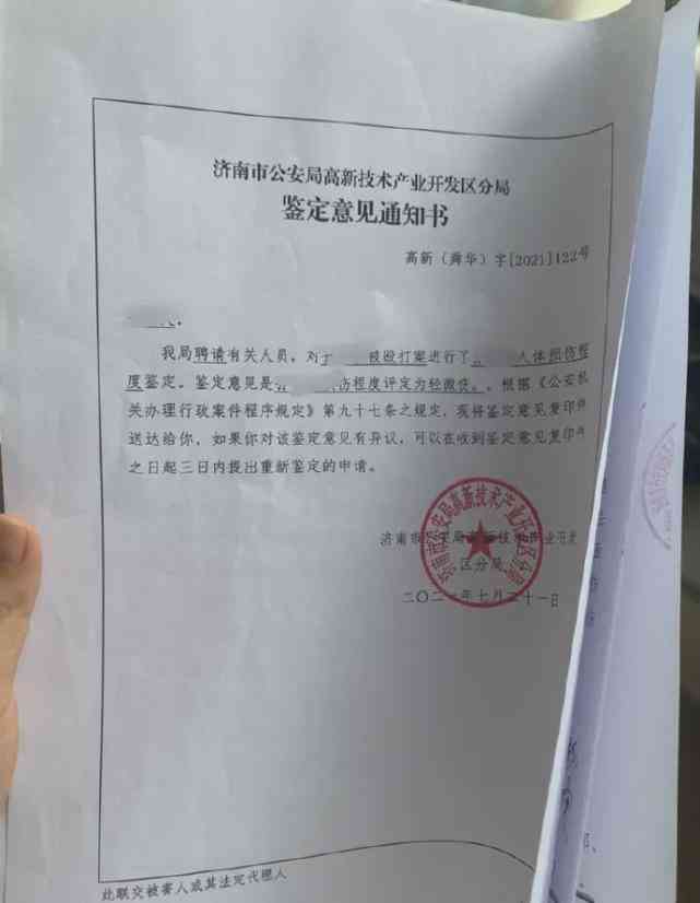 牙被打掉半截能认定工伤吗，工伤认定标准详解