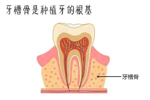 工伤牙齿脱落与牙槽骨损伤伤残鉴定标准及赔偿解析
