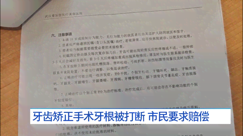 牙齿断了三颗算轻伤吗：如何赔偿及伤残级别判定