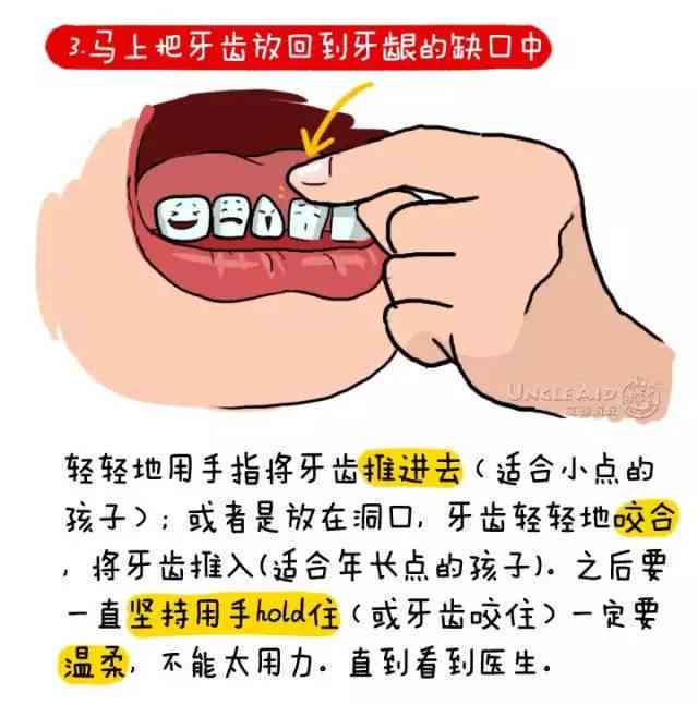 牙齿碰断三颗能认定工伤吗 牙齿碰断三颗能认定工伤吗
