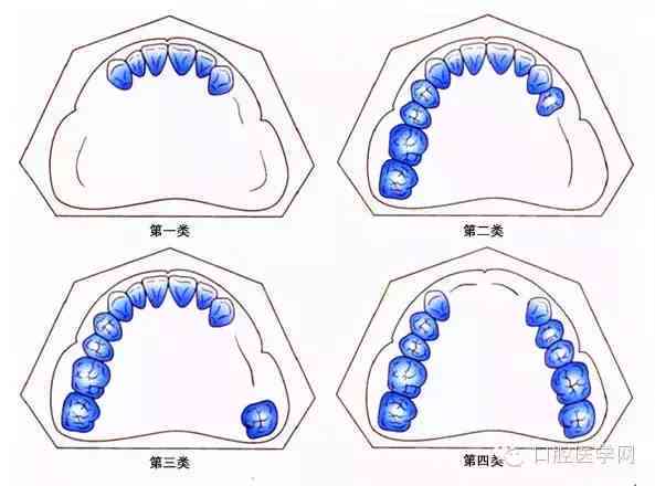 牙齿缺失是否构成伤残：鉴定标准及伤残等级划分