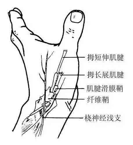 狭窄性腱鞘炎能认定工伤几级吗，手术及工伤待遇解析