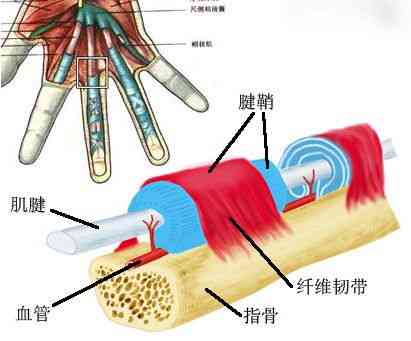 探讨狭窄性腱鞘炎：职业劳损能否界定为工伤？