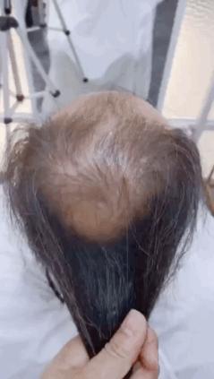 这一问题nn探讨上班期间上厕所是否属于工伤：法律解读与案例分析