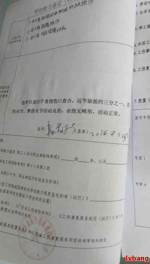 甲状腺功能进症工伤认定细则及判定标准