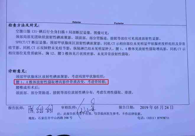 甲状腺癌可以评伤残吗：涉及工伤认定、鉴定流程及费用解析