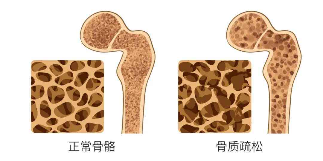 甲癌工伤认定指南：全面解析如何判定职业癌症为工伤情况