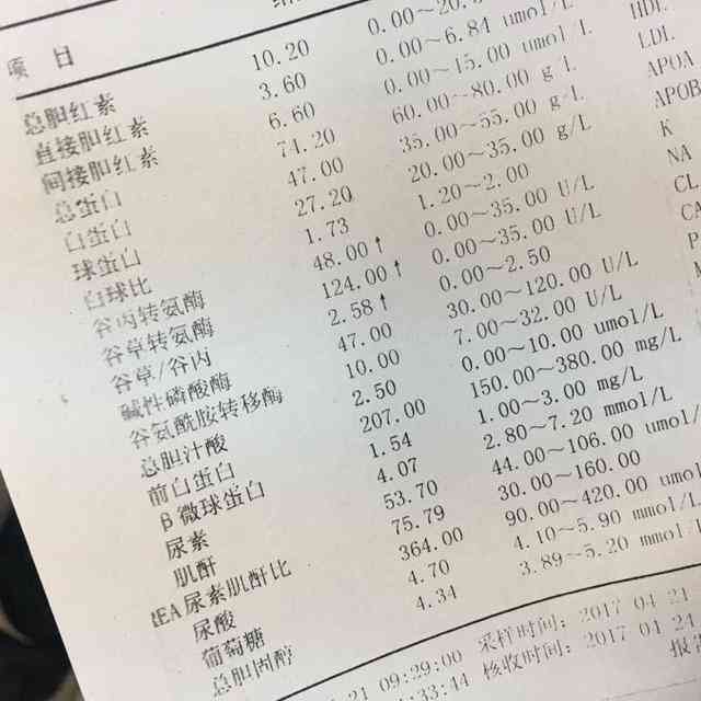 ai可以看体检报告吗：如何查看体检报告的及查询准确性