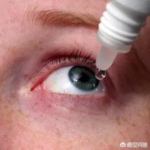 电焊烧伤导致眼部损伤，预计恢复时长解析