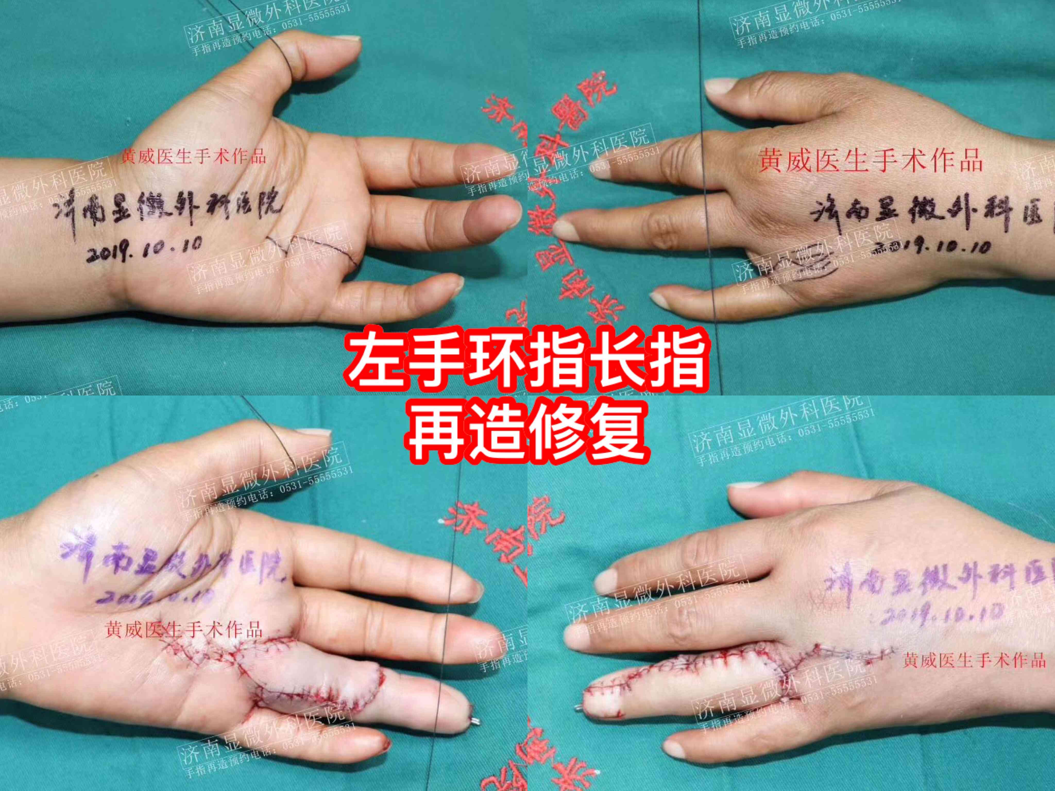 工伤职工重新申请鉴定须知：必备材料与办理流程详解