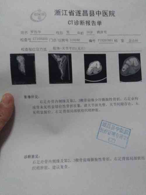 疝气能评上几级伤残，是否能认定为工伤及残疾等级标准详解