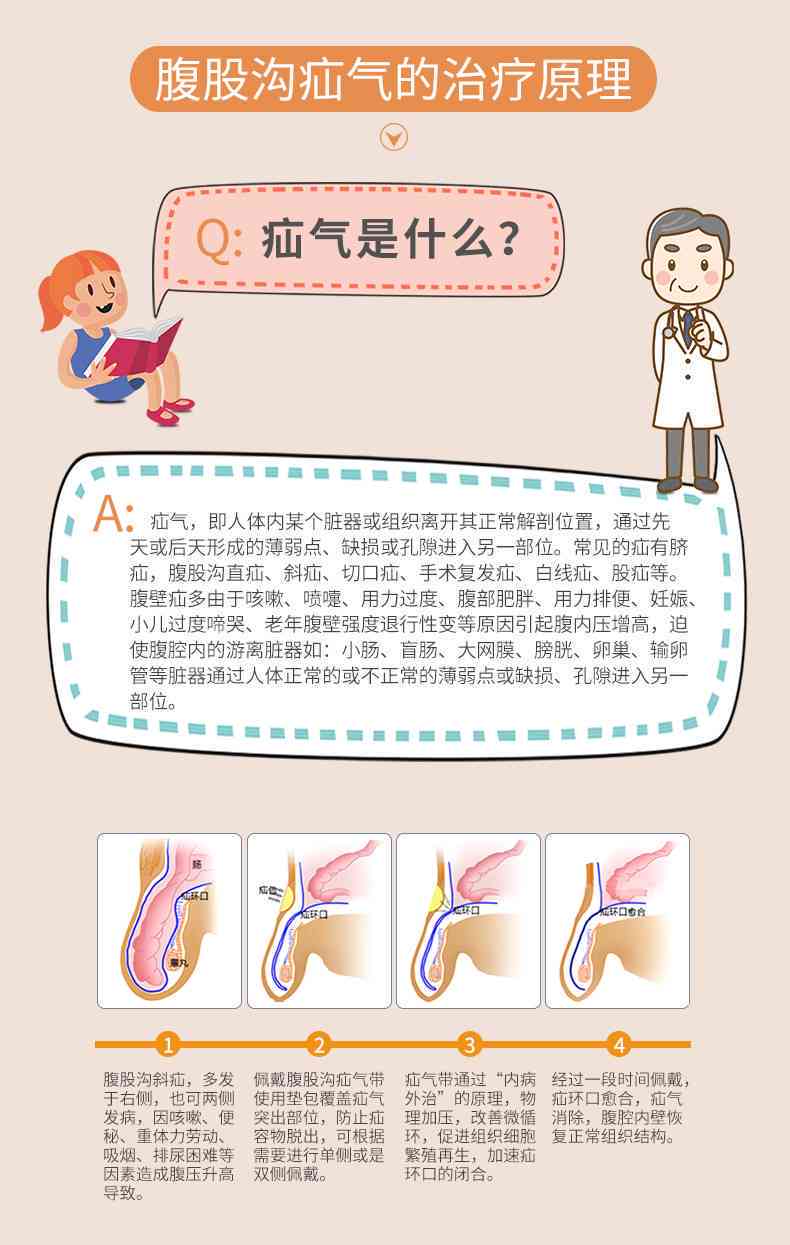 疝气病症是否可被认定为职业工伤的情形探讨