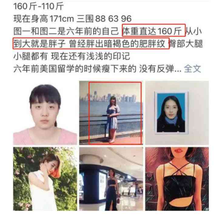出国工作期间感染疟疾：工伤认定的条件、流程与案例分析