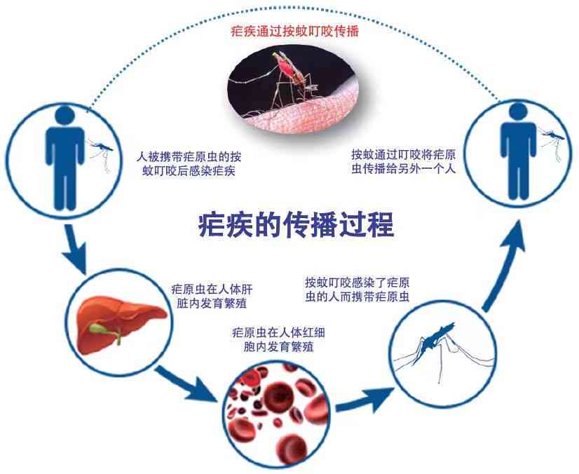 疟疾是否被归类为重大传染病：探讨其在公共生中的重要性