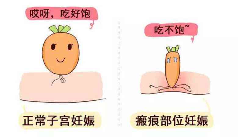 疤痕算不算工伤：工伤事故范围、等级与伤残认定及瘢痕计算方式