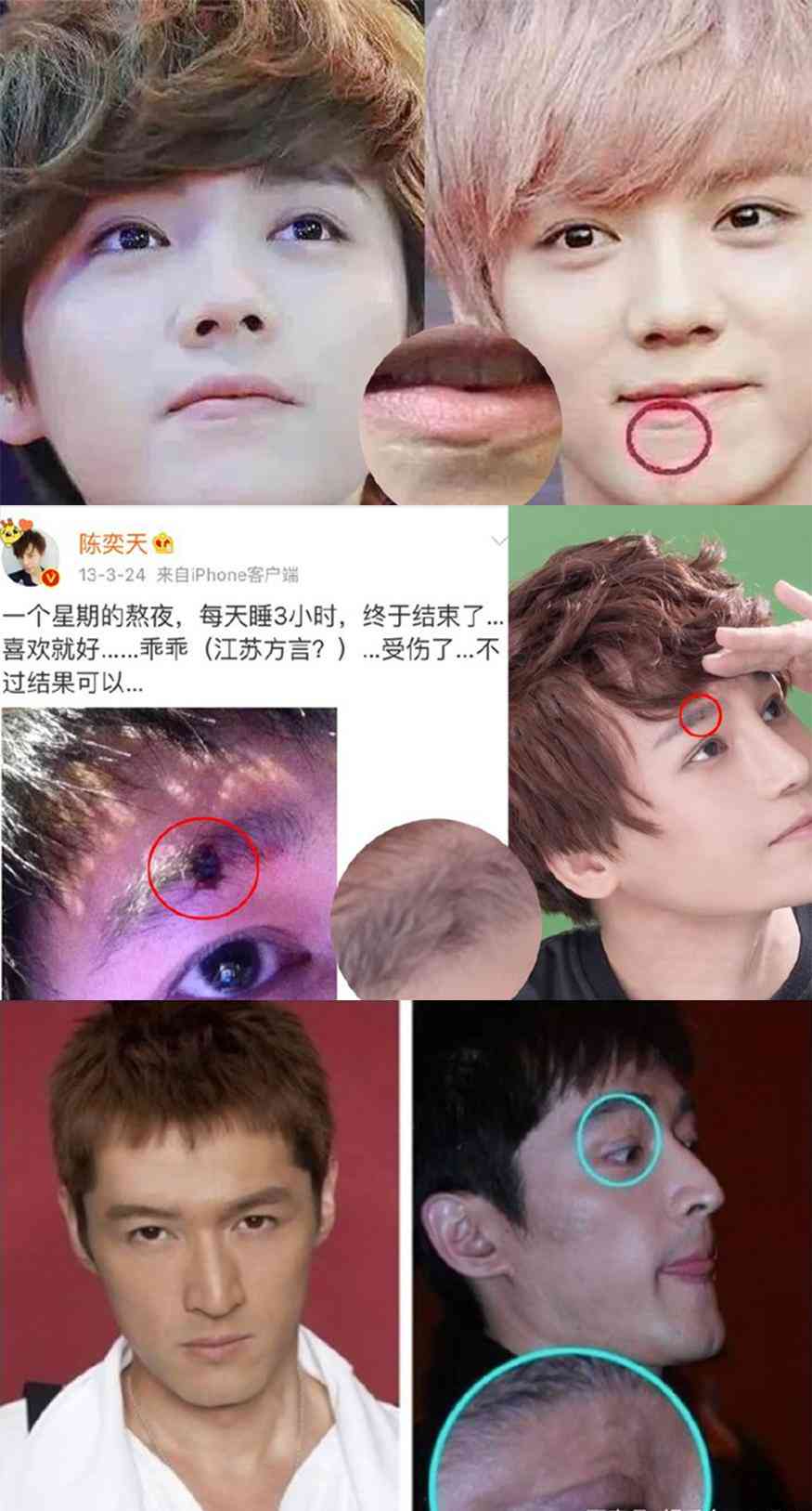 疤痕怎么认定工伤伤残等级