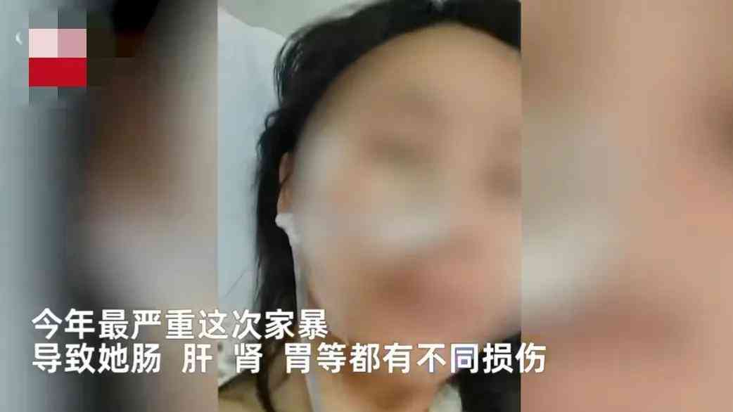 疤痕长度与残疾评定标准：全面解读不同部位疤痕评级条件及流程