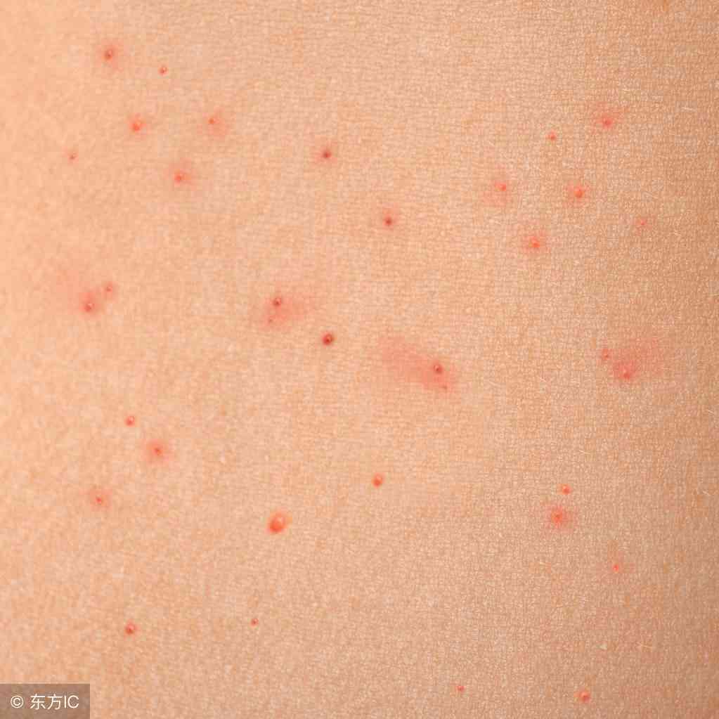 全面解析：严重急性疾病的症状、预防与紧急处理指南