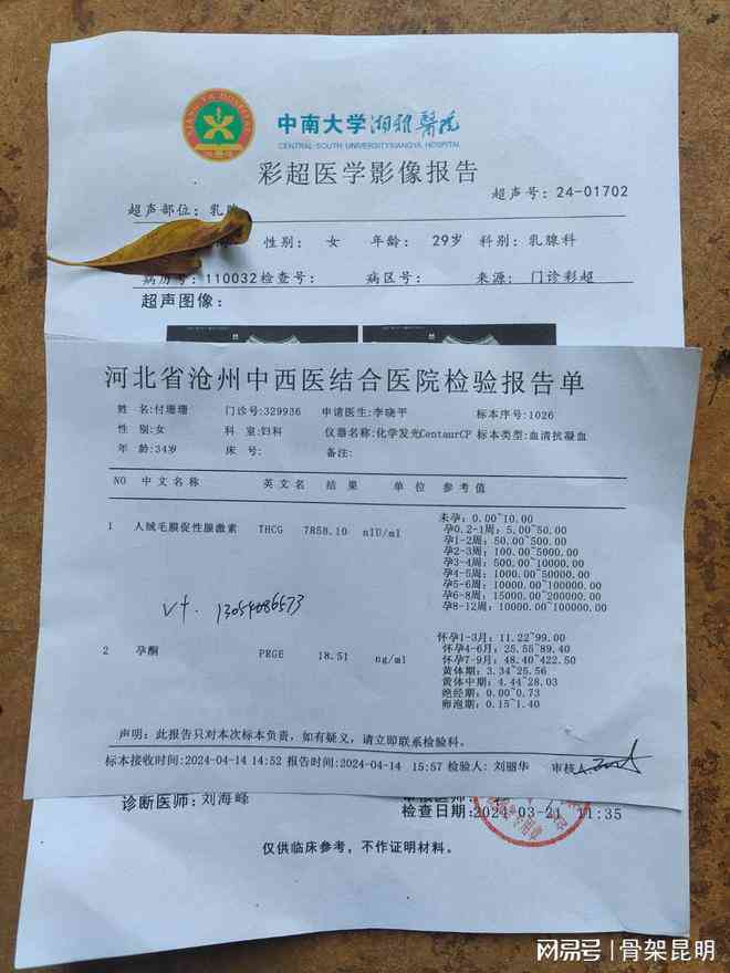 病历有肾挫伤能认定工伤吗 病历有肾挫伤能认定工伤吗