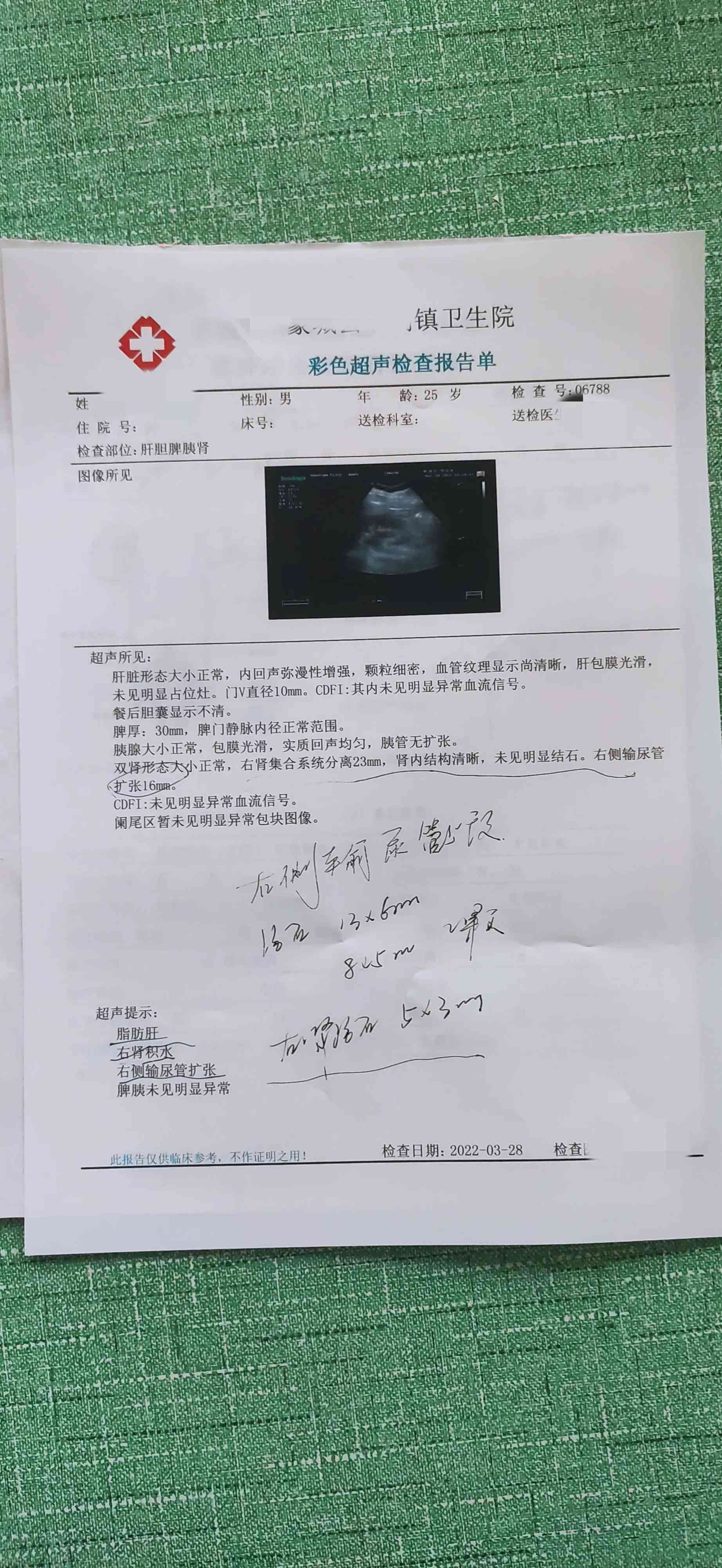 病历可以鉴定吗：病历作为诊断证明及证据的鉴定方法与适用性探讨
