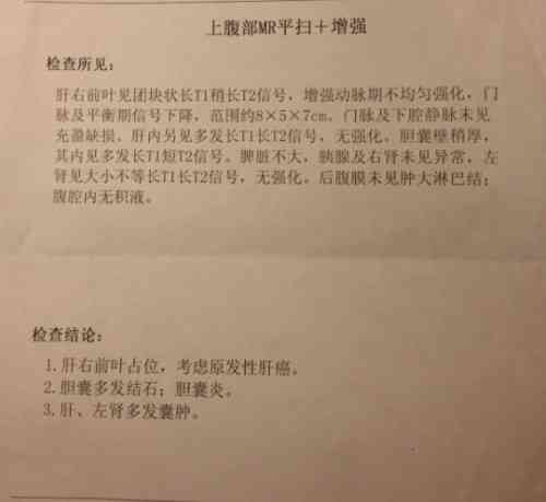 病历书写错误属于医疗事故吗：法律责任、后果及处理方法